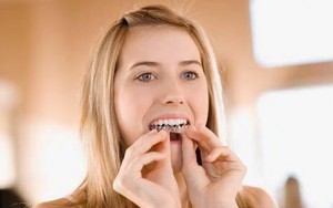 tẩy trắng răng tại nhà