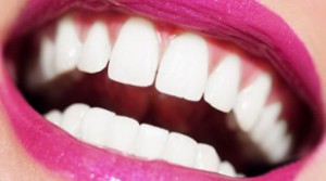 Tẩy Trắng Răng Giá Rẻ Bình Thạnh